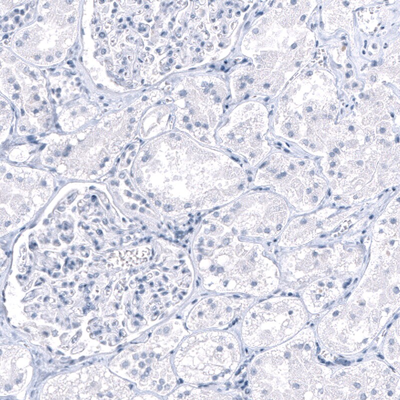 Immunohistochemistry-Paraffin: PNMT Antibody [NBP3-21193] -