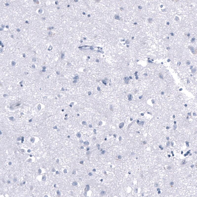 Immunohistochemistry-Paraffin: PNMT Antibody [NBP3-21193] -