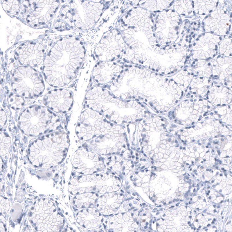 Immunohistochemistry-Paraffin: PNMT Antibody [NBP3-21193] -