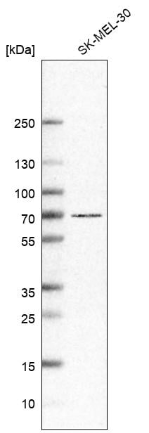 Western Blot: GPR97 Antibody [NBP3-21194] -