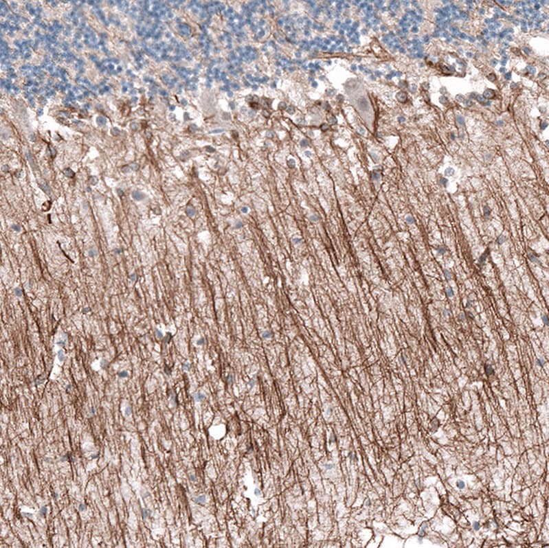 Immunohistochemistry-Paraffin: P2X7/P2RX7 Antibody [NBP3-21196] -