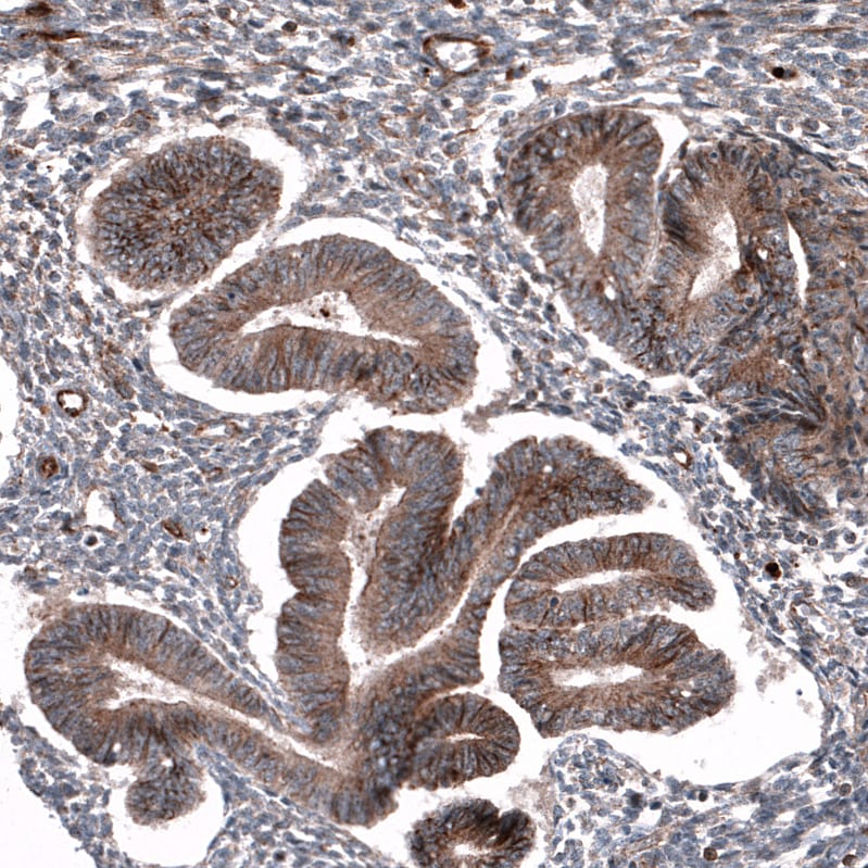 Immunohistochemistry-Paraffin: P2X7/P2RX7 Antibody [NBP3-21196] -