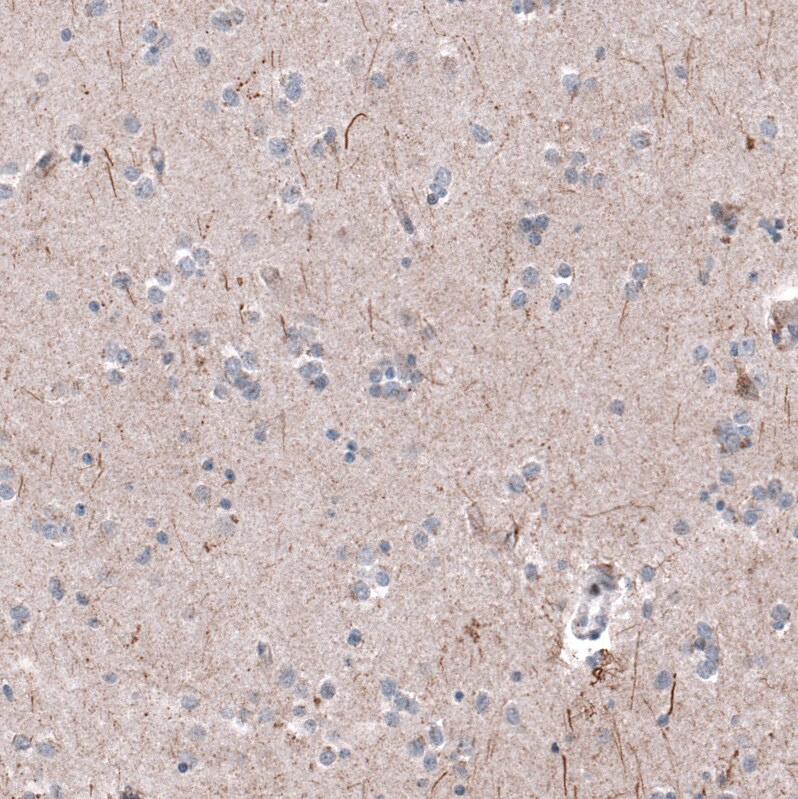 Immunohistochemistry-Paraffin: P2X7/P2RX7 Antibody [NBP3-21196] -
