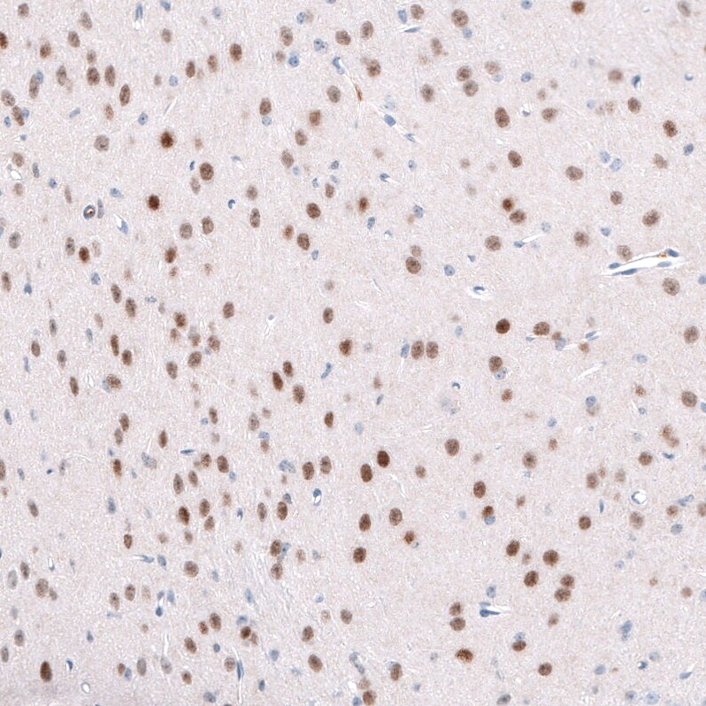 Immunohistochemistry-Paraffin: TCF7L2 Antibody [NBP3-21197] -