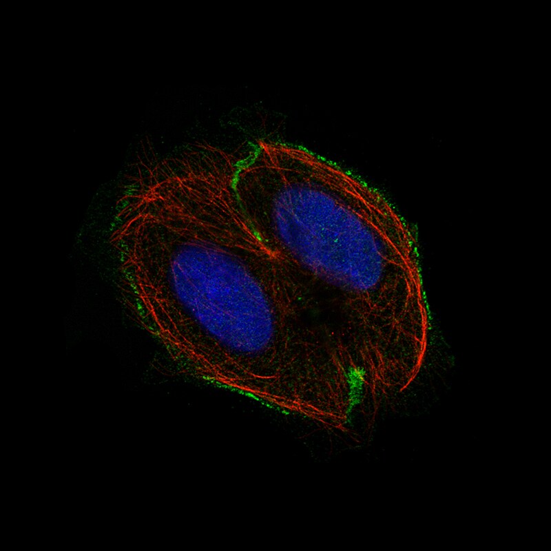 Immunocytochemistry/Immunofluorescence: M-CSFR/CD115 Antibody [NBP3-21198] -