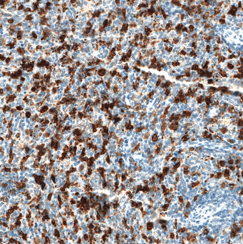 Immunohistochemistry-Paraffin: HO-1/HMOX1/HSP32 Antibody [NBP3-21199] -