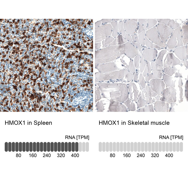 Immunohistochemistry-Paraffin: HO-1/HMOX1/HSP32 Antibody [NBP3-21199] -