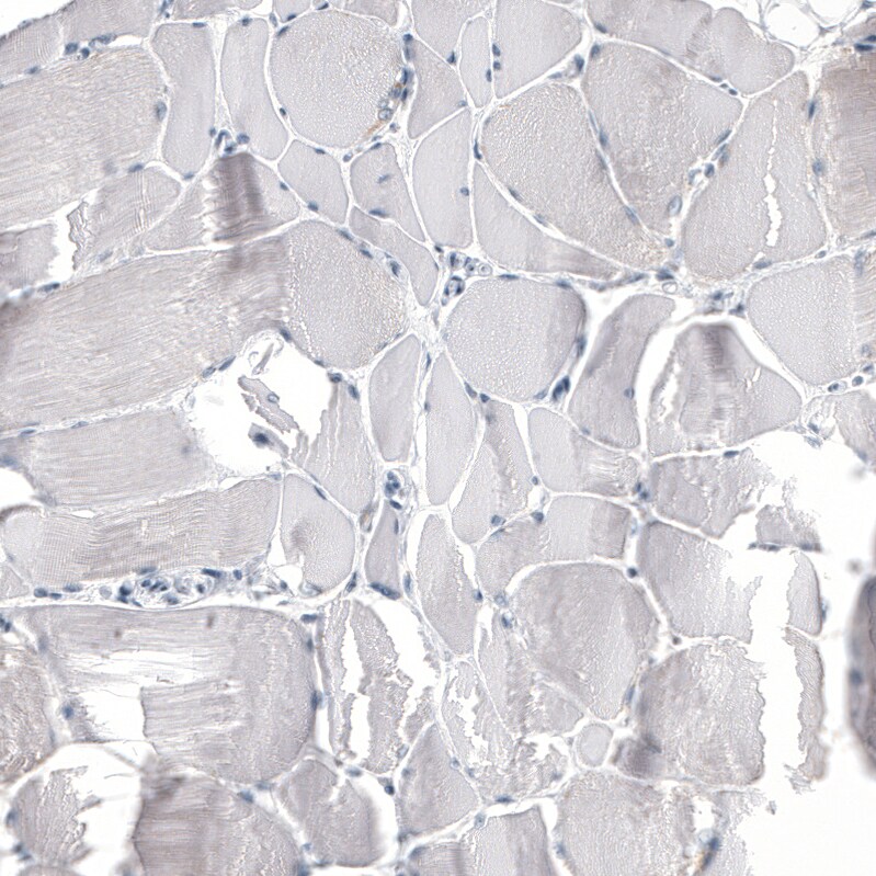 Immunohistochemistry-Paraffin: HO-1/HMOX1/HSP32 Antibody [NBP3-21199] -