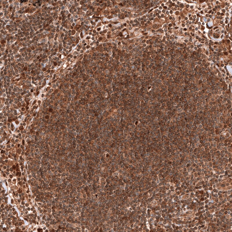Immunohistochemistry-Paraffin: PTEN Antibody [NBP3-21200] -