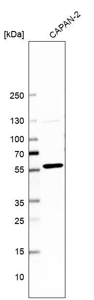 Western Blot: PTEN Antibody [NBP3-21200] -