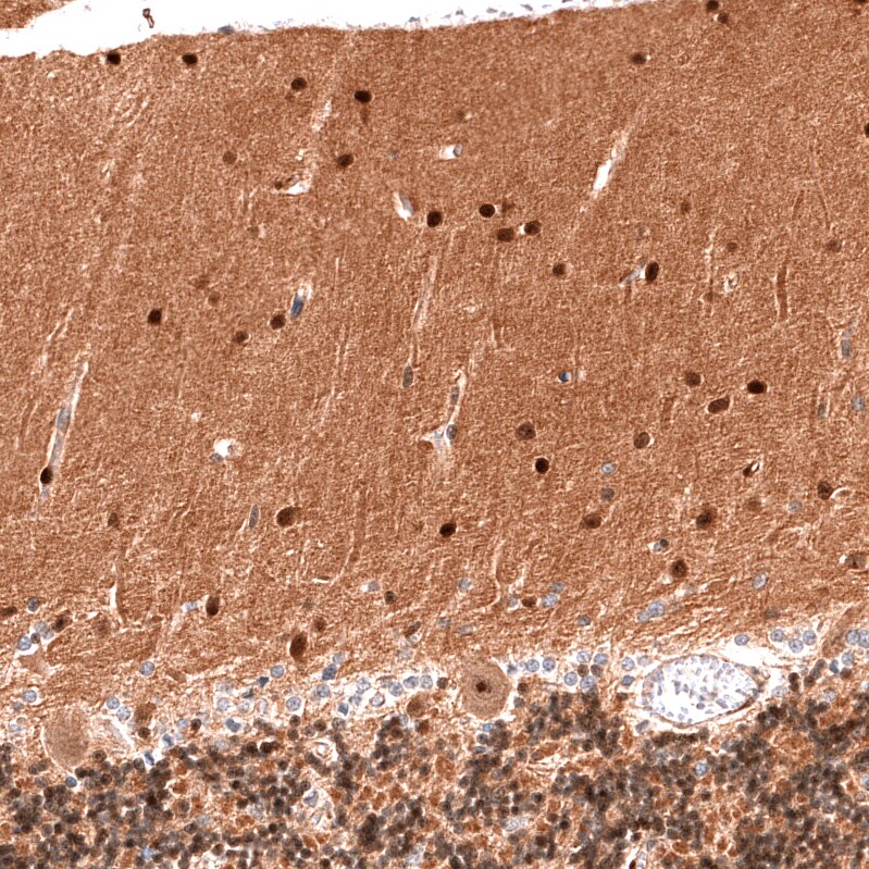Immunohistochemistry-Paraffin: PTEN Antibody [NBP3-21200] -