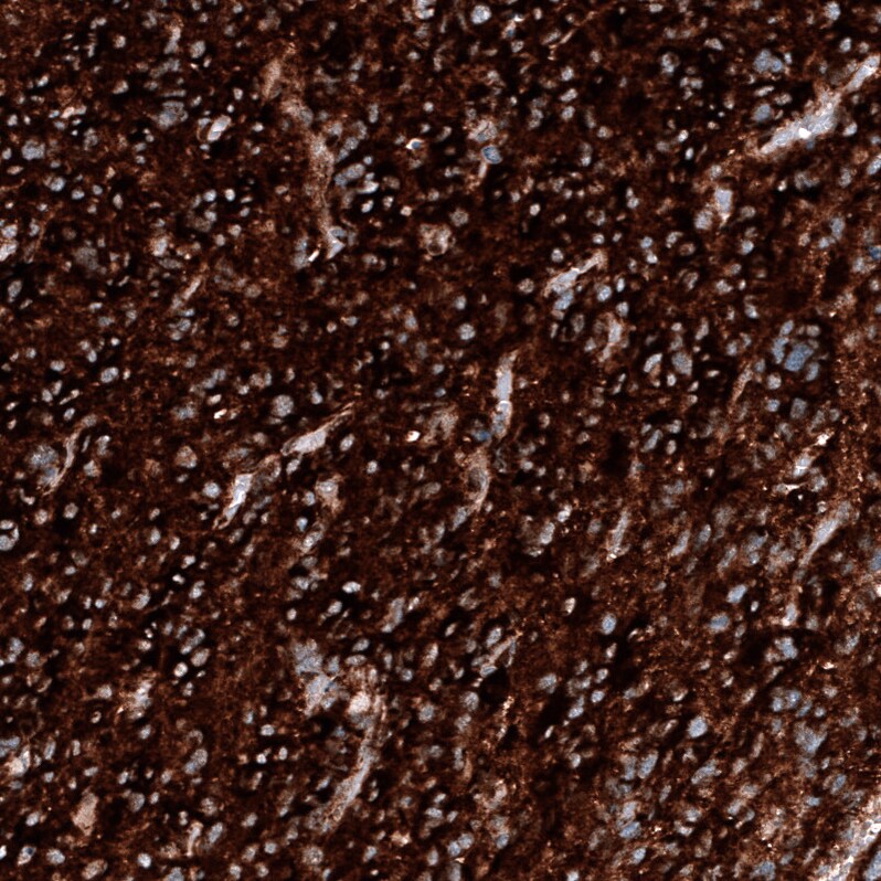 Immunohistochemistry-Paraffin: PTEN Antibody [NBP3-21201] -