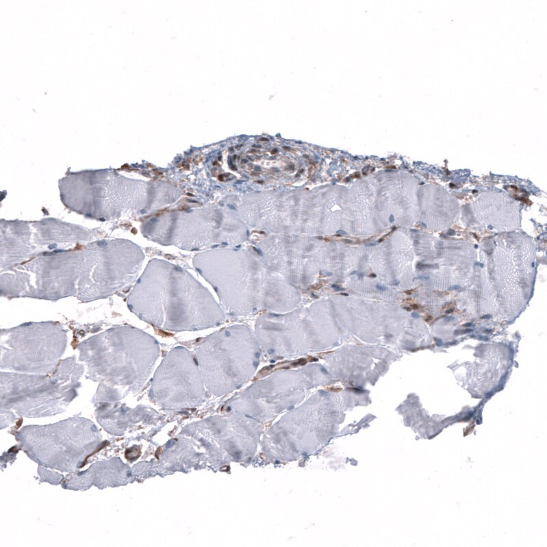 Immunohistochemistry-Paraffin: PTEN Antibody [NBP3-21201] -