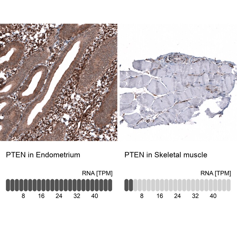 Immunohistochemistry-Paraffin: PTEN Antibody [NBP3-21201] -