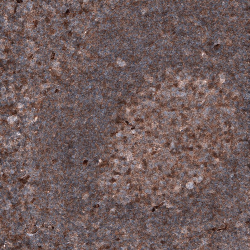 Immunohistochemistry-Paraffin: PTEN Antibody [NBP3-21201] -