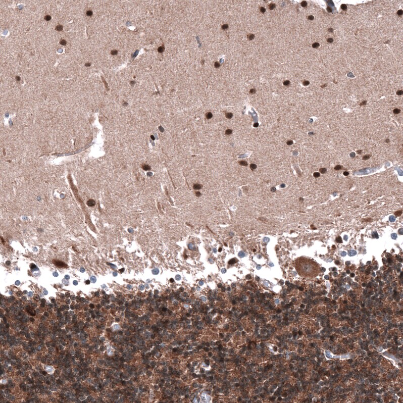 Immunohistochemistry-Paraffin: PTEN Antibody [NBP3-21201] -