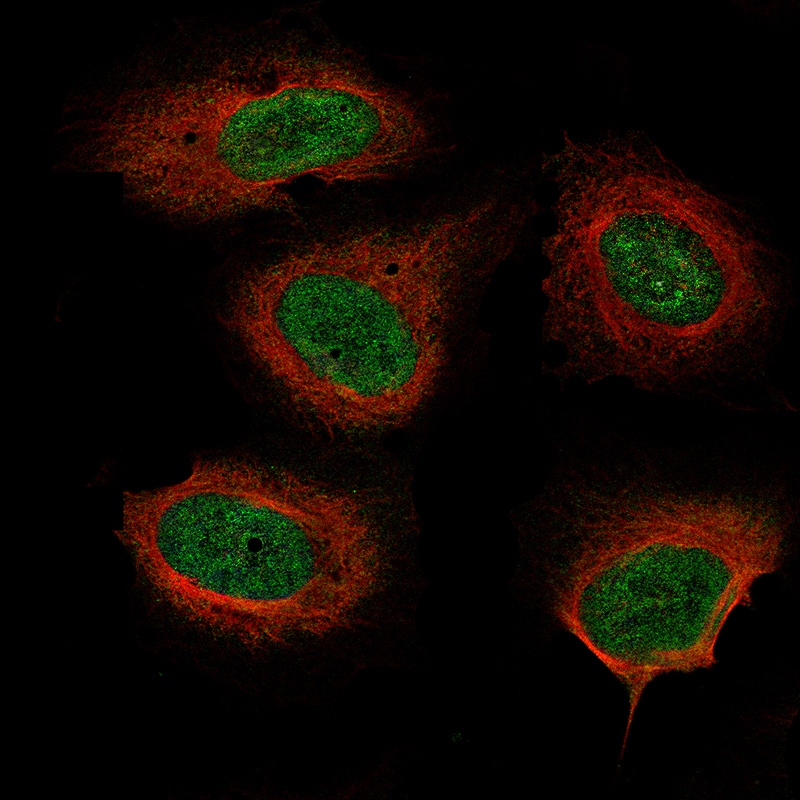 Neurofibromin 1 Antibody (CL11773) - BSA Free Immunocytochemistry/ Immunofluorescence: Neurofibromin 1 Antibody (CL11773) - BSA Free [NBP3-21202]