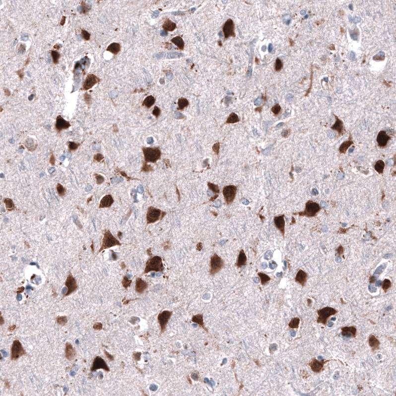 Immunohistochemistry-Paraffin: RBFOX3/NeuN Antibody [NBP3-21203] -