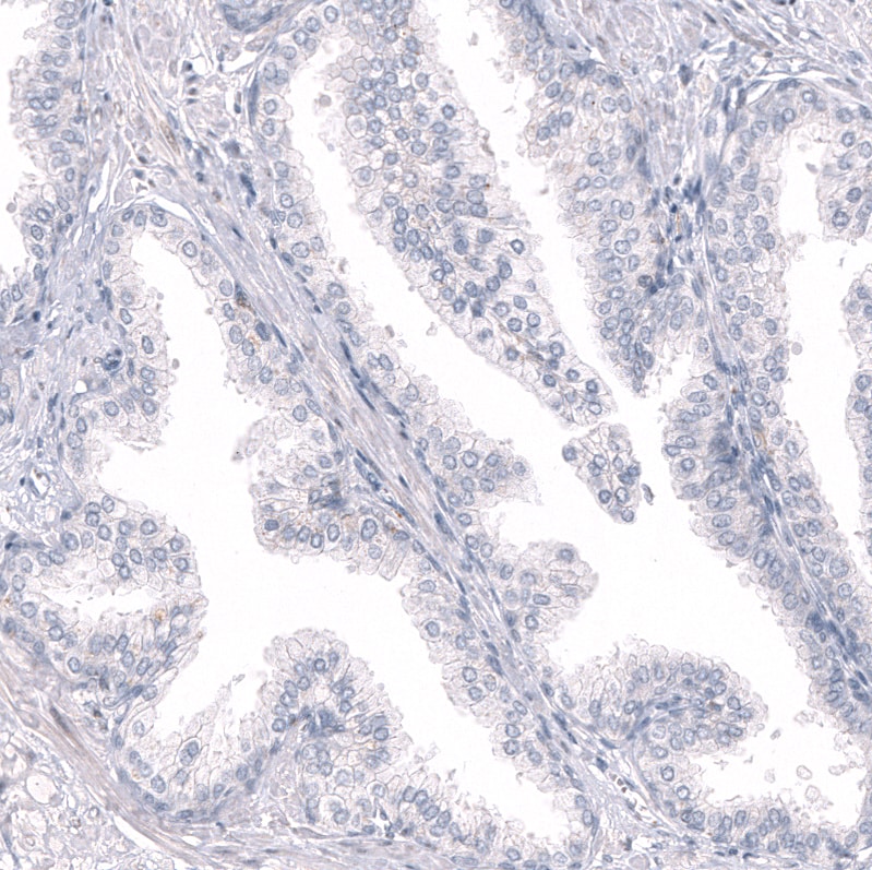 Immunohistochemistry-Paraffin: RBFOX3/NeuN Antibody [NBP3-21203] -
