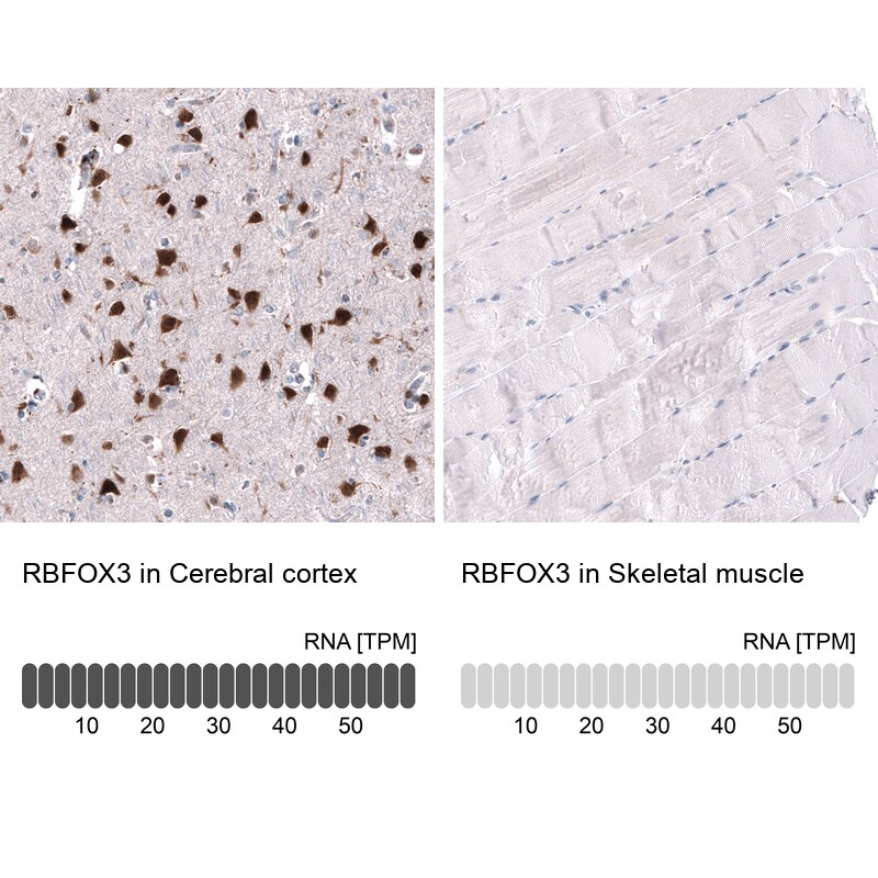 Immunohistochemistry-Paraffin: RBFOX3/NeuN Antibody [NBP3-21203] -