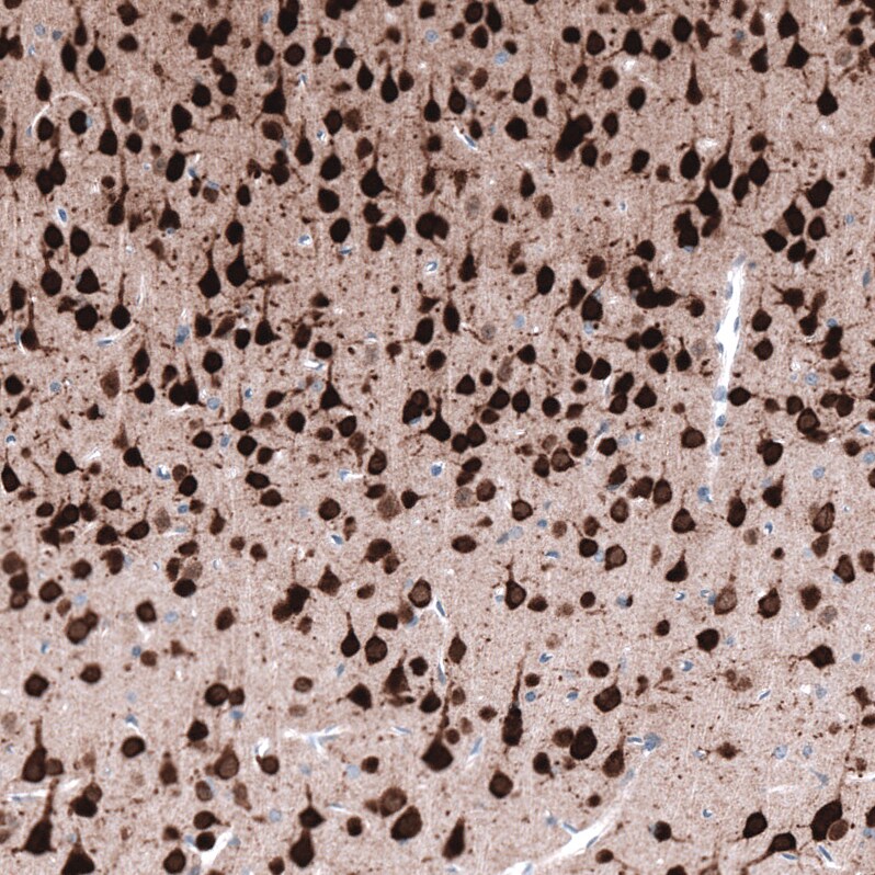 Immunohistochemistry-Paraffin: RBFOX3/NeuN Antibody [NBP3-21203] -