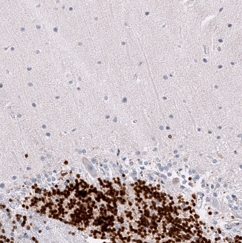 Immunohistochemistry-Paraffin: RBFOX3/NeuN Antibody [NBP3-21203] -