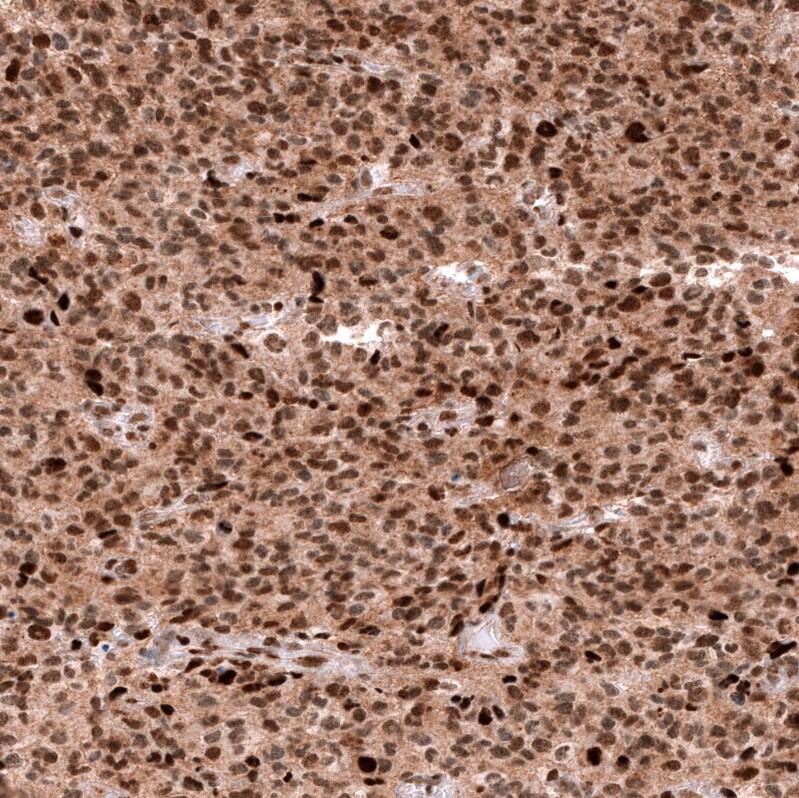 Immunohistochemistry-Paraffin: EZH2/KMT6 Antibody [NBP3-21204] -