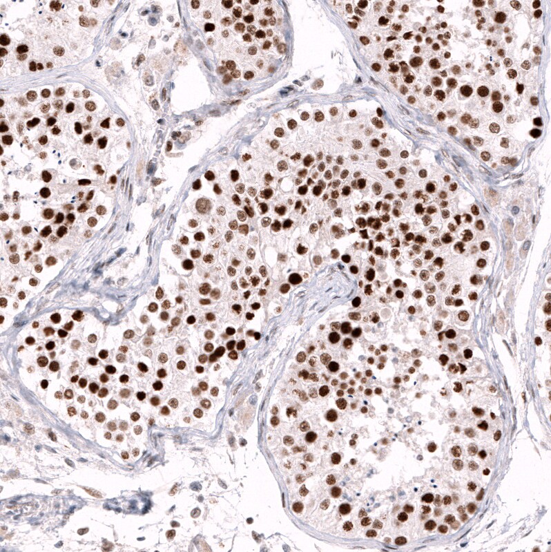 Immunohistochemistry-Paraffin: EZH2/KMT6 Antibody [NBP3-21204] -