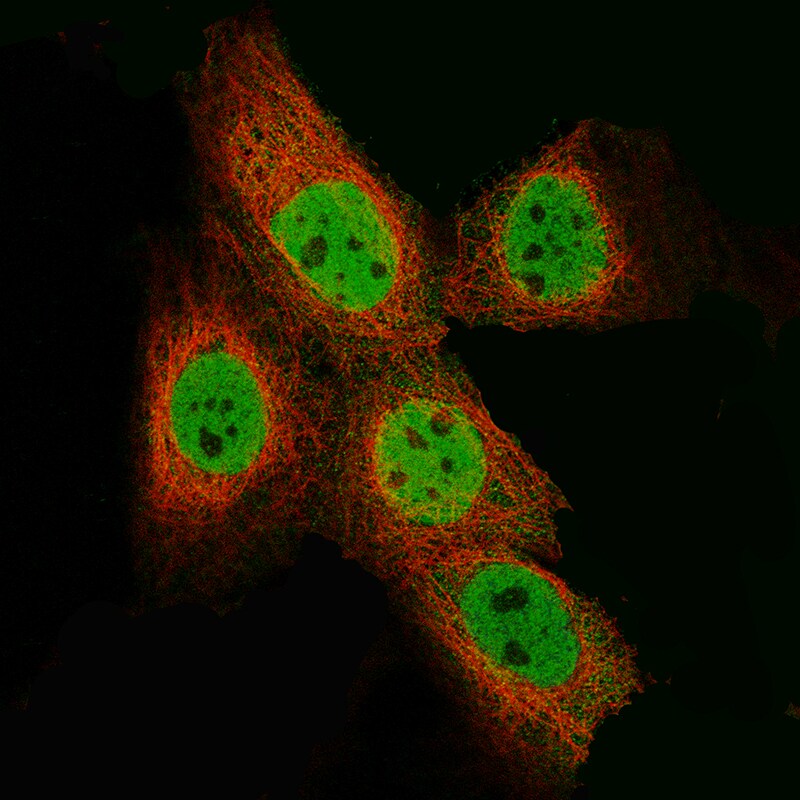 EZH2/KMT6 Antibody (CL11945) - BSA Free Immunocytochemistry/ Immunofluorescence: EZH2/KMT6 Antibody (CL11945) - BSA Free[NBP3-21205]