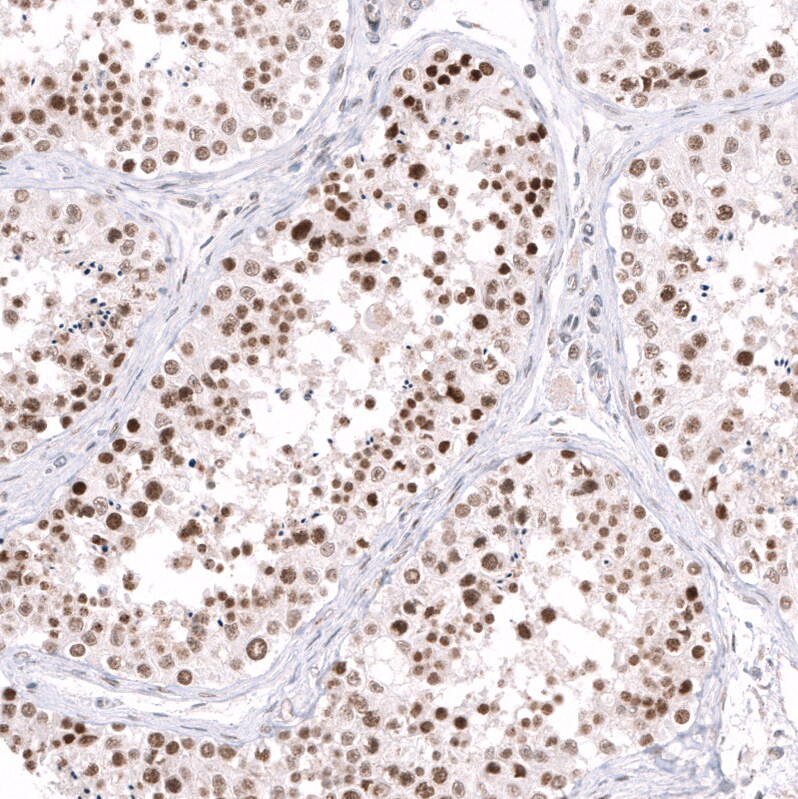 Immunohistochemistry-Paraffin: EZH2/KMT6 Antibody [NBP3-21205] -