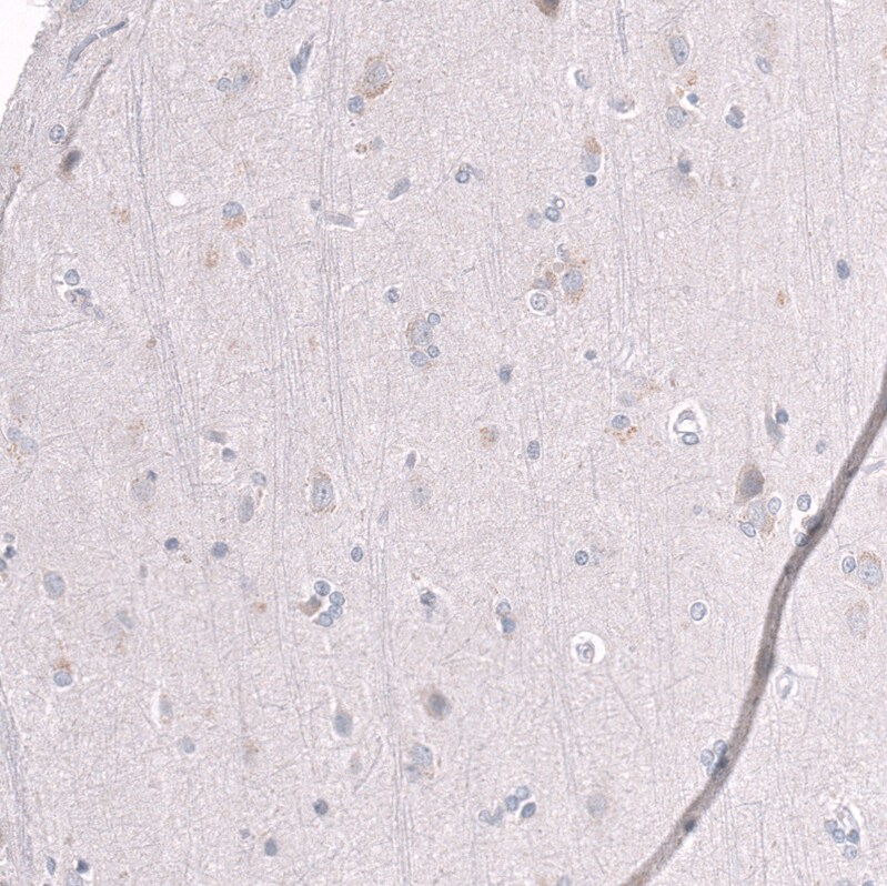 Immunohistochemistry-Paraffin: EZH2/KMT6 Antibody [NBP3-21205] -