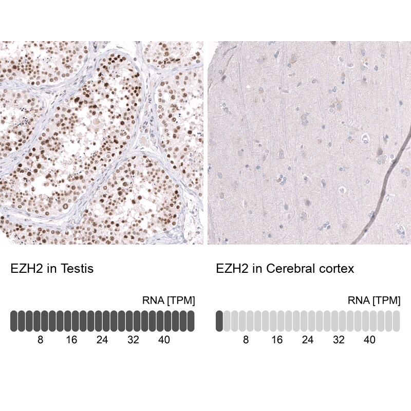 Immunohistochemistry-Paraffin: EZH2/KMT6 Antibody [NBP3-21205] -