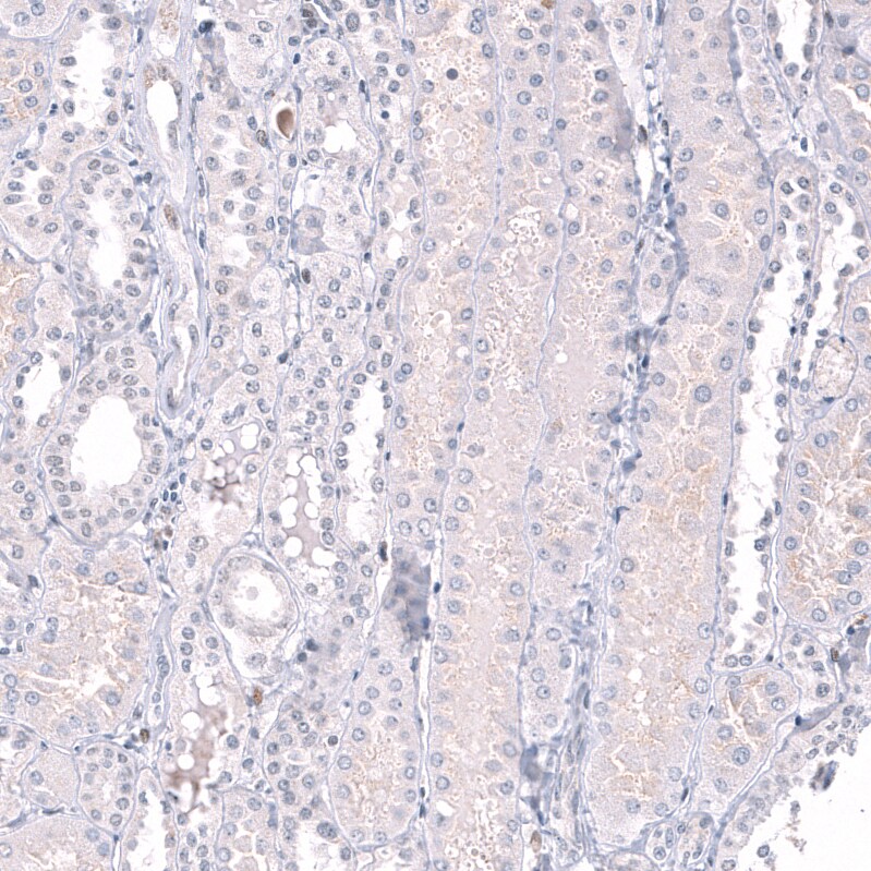 Immunohistochemistry-Paraffin: EZH2/KMT6 Antibody [NBP3-21205] -