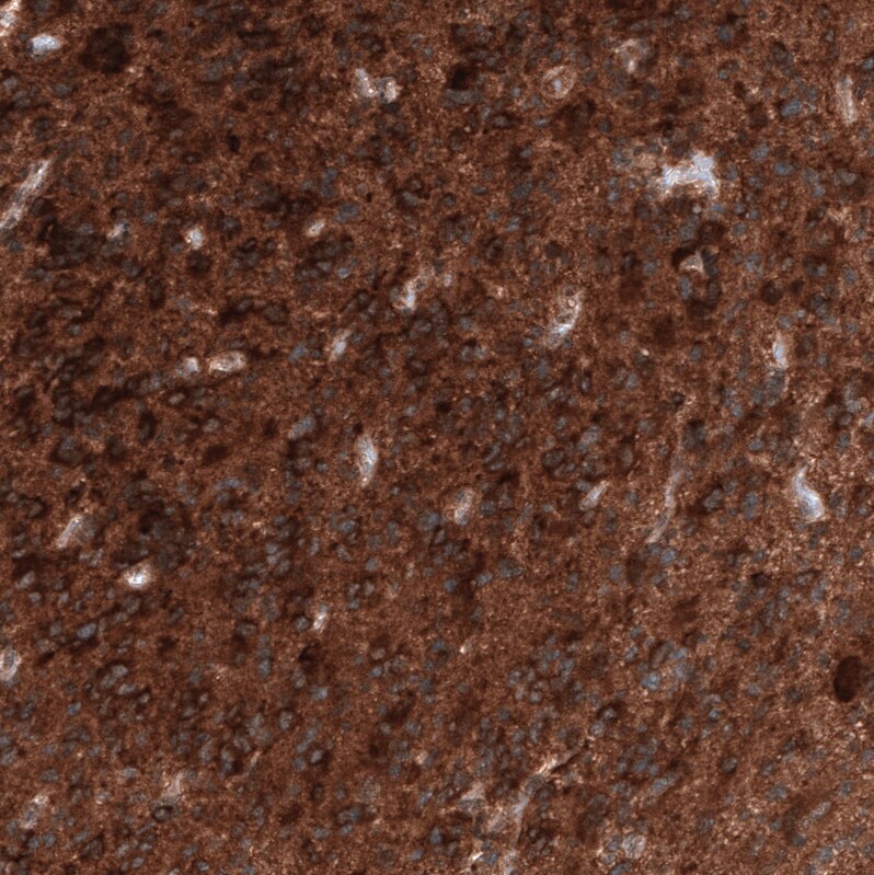 Immunohistochemistry-Paraffin: ID1 Antibody [NBP3-21206] -