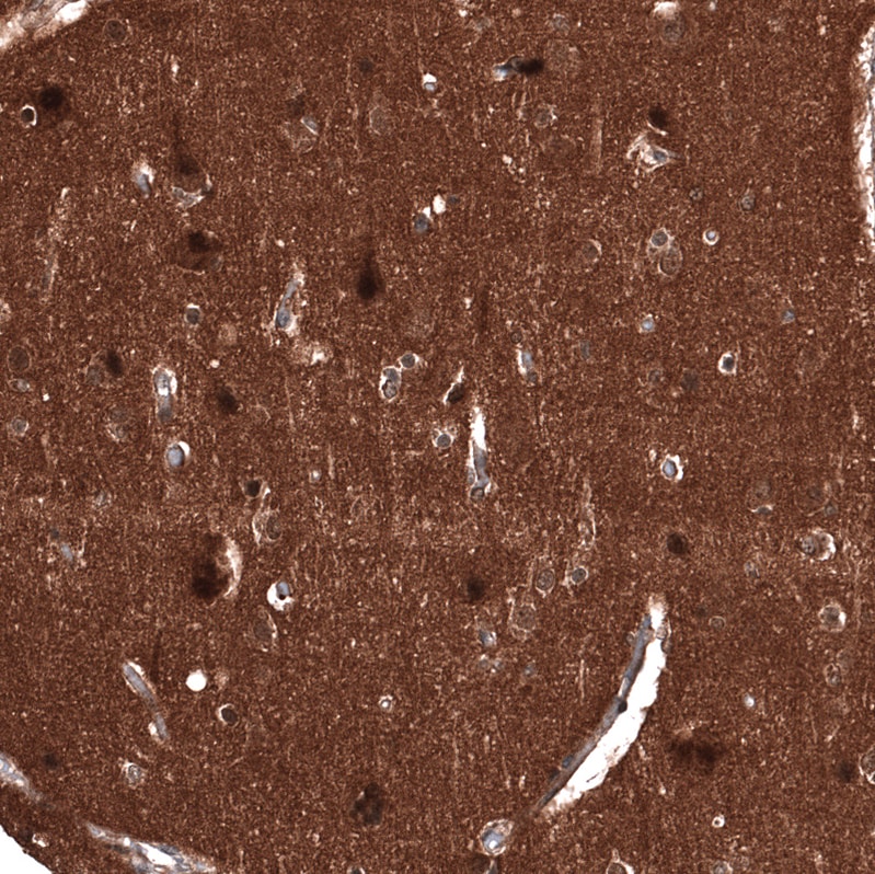 Immunohistochemistry-Paraffin: ID1 Antibody [NBP3-21206] -