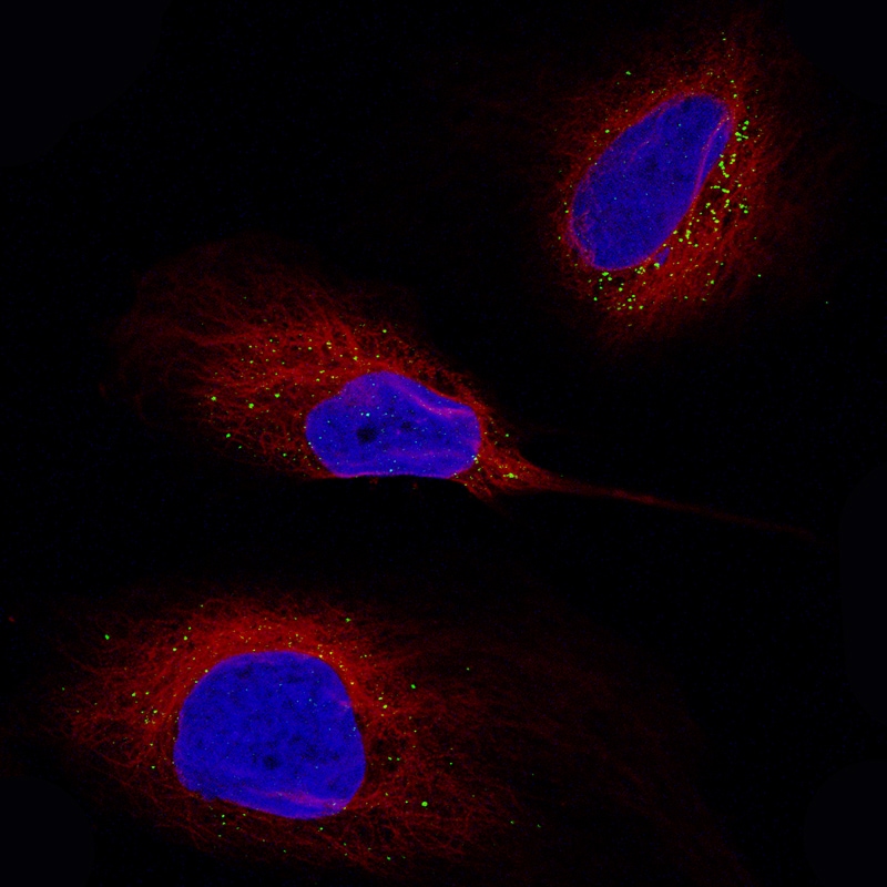 Periostin/OSF-2 Antibody (CL12090) - BSA Free Immunocytochemistry/ Immunofluorescence: Periostin/OSF-2 Antibody (CL12090) - BSA Free[NBP3-21207]