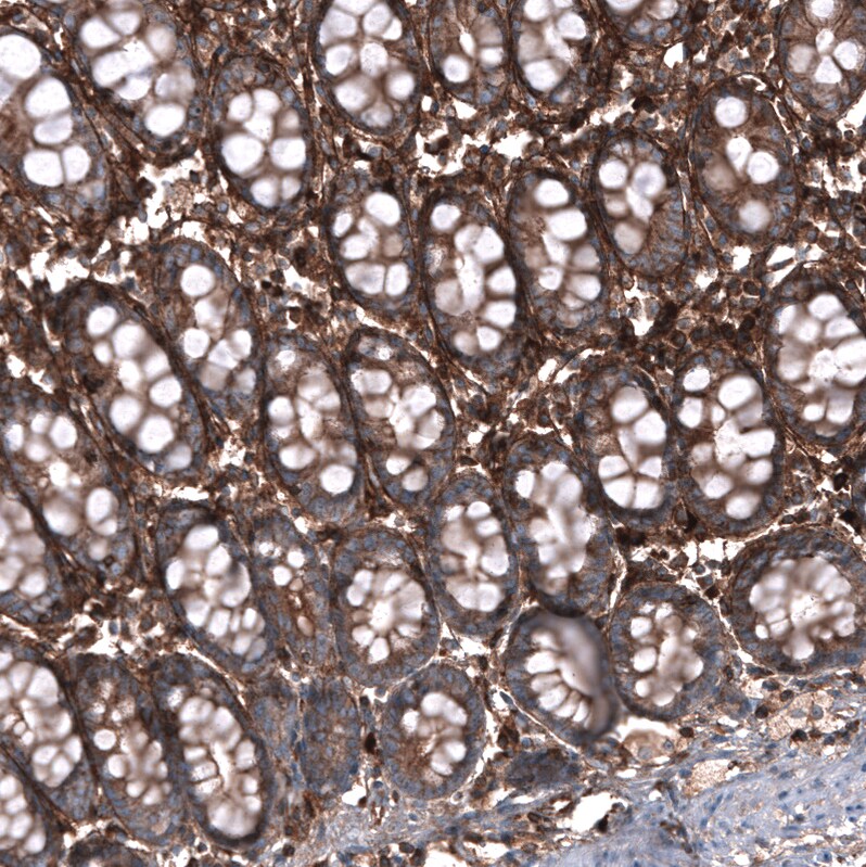 Immunohistochemistry-Paraffin: Periostin/OSF-2 Antibody [NBP3-21207] -