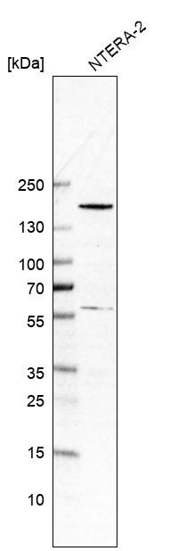 Western Blot: SALL4 Antibody [NBP3-21208] -