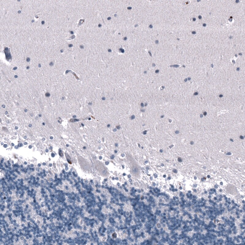 Immunohistochemistry-Paraffin: SALL4 Antibody [NBP3-21208] -