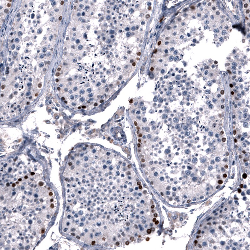 Immunohistochemistry-Paraffin: SALL4 Antibody [NBP3-21208] -