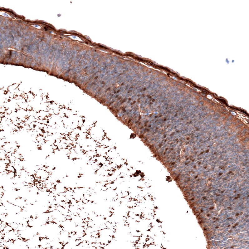 Immunohistochemistry-Paraffin: SALL4 Antibody [NBP3-21208] -