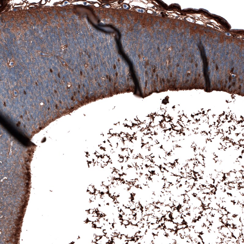 Immunohistochemistry-Paraffin: SALL4 Antibody [NBP3-21209] -