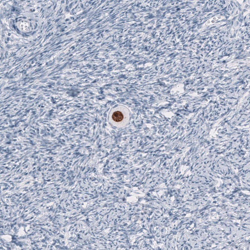 Immunohistochemistry-Paraffin: SALL4 Antibody [NBP3-21209] -