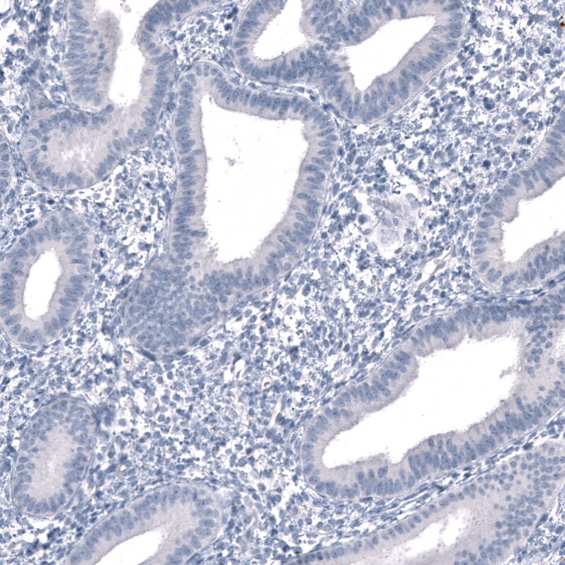 Immunohistochemistry-Paraffin: SALL4 Antibody [NBP3-21209] -