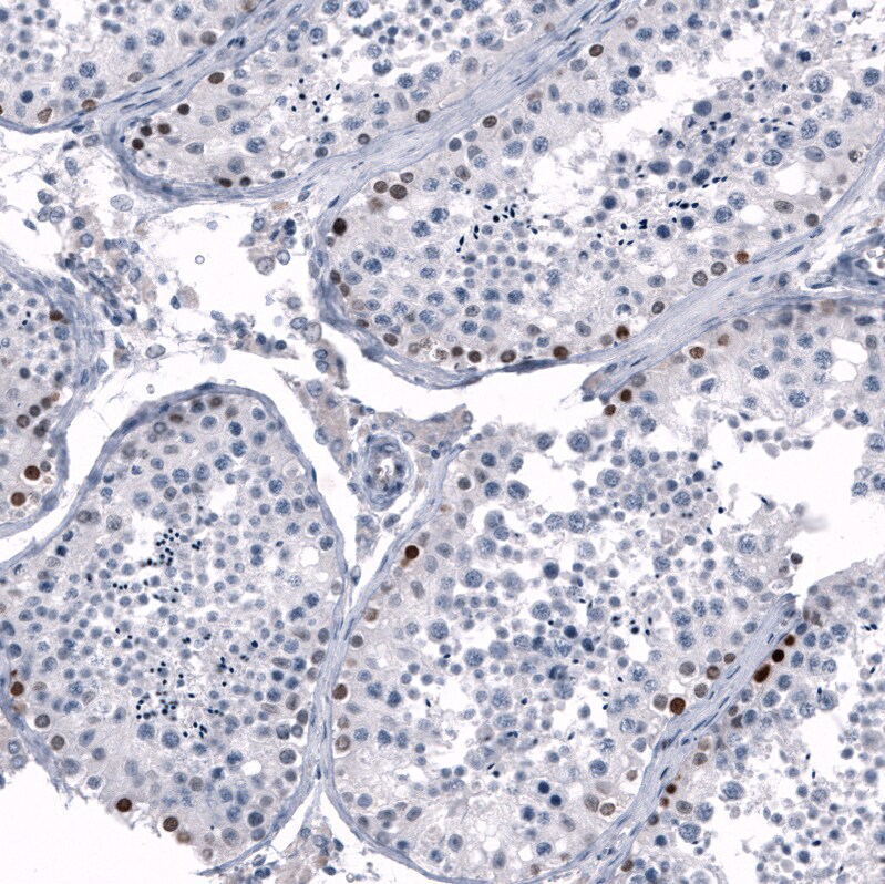 Immunohistochemistry-Paraffin: SALL4 Antibody [NBP3-21209] -