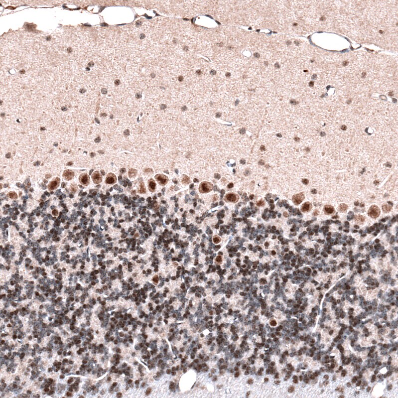 Immunohistochemistry-Paraffin: GLI-1 Antibody [NBP3-21211] -