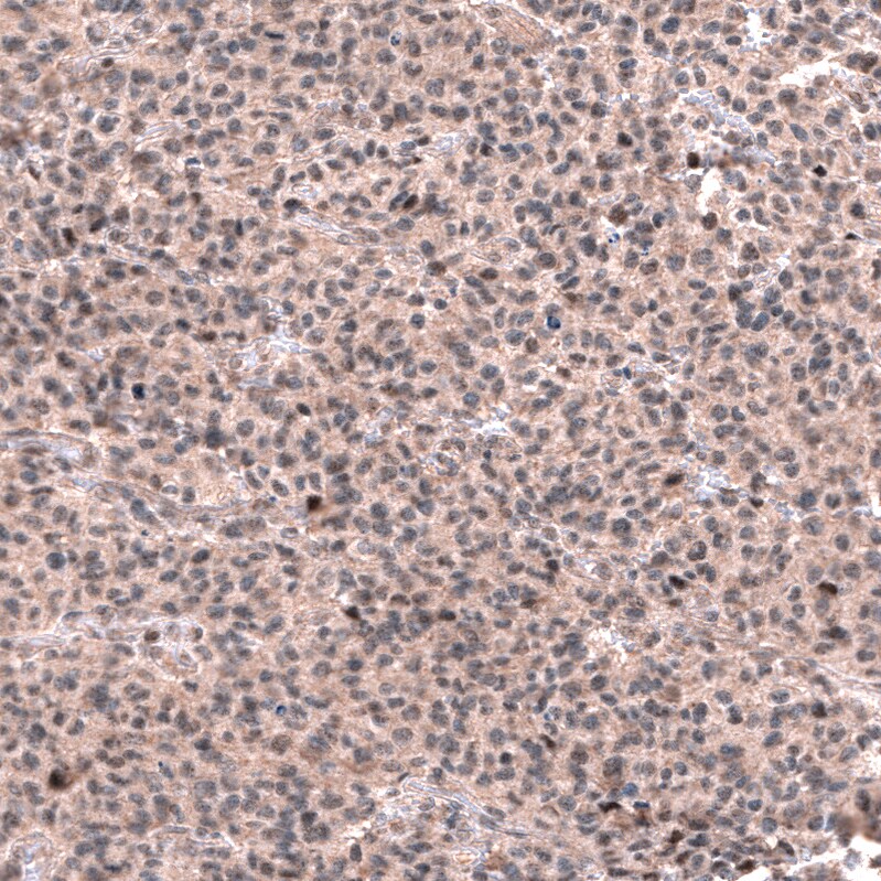 Immunohistochemistry-Paraffin: GLI-1 Antibody [NBP3-21211] -
