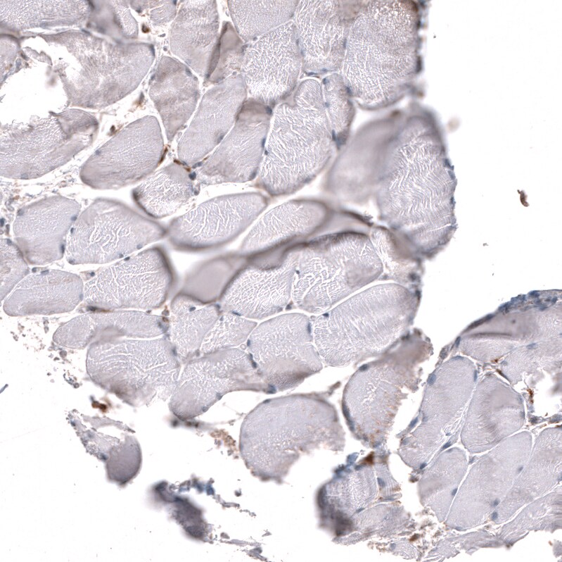 Immunohistochemistry-Paraffin: Chitinase 3-like 1 Antibody [NBP3-21212] -