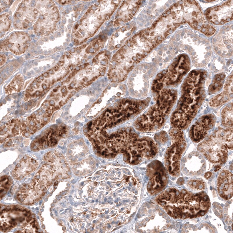 Immunohistochemistry-Paraffin: Chitinase 3-like 1 Antibody [NBP3-21212] -