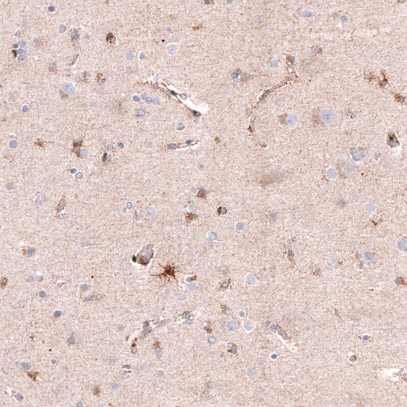 Immunohistochemistry-Paraffin: Chitinase 3-like 1 Antibody [NBP3-21212] -